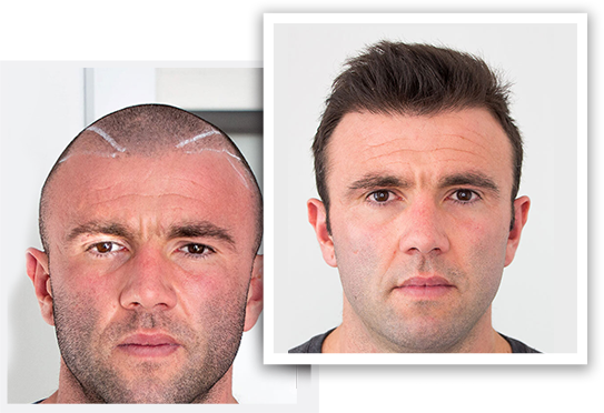 <span>At Pure Line Clinic®</span> Results