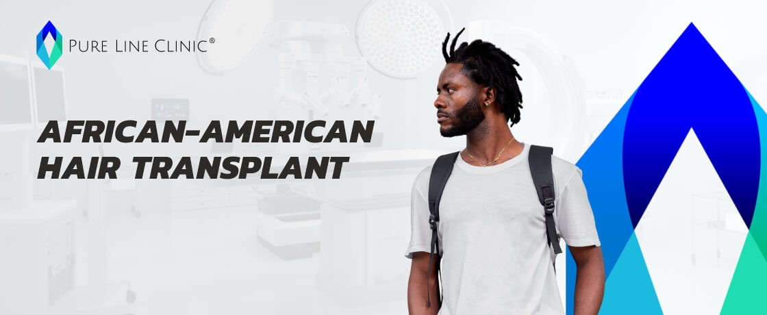 African American Hair Transplant