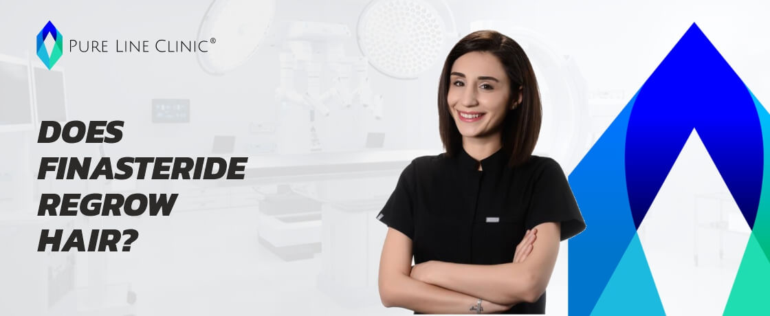 Does Finasteride Regrow Hair ?