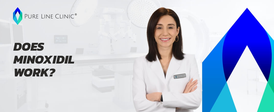 Does Minoxidil Work?