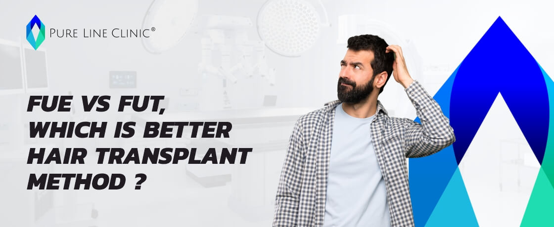 FUE vs FUT, Which is Better Hair Transplant Method ?