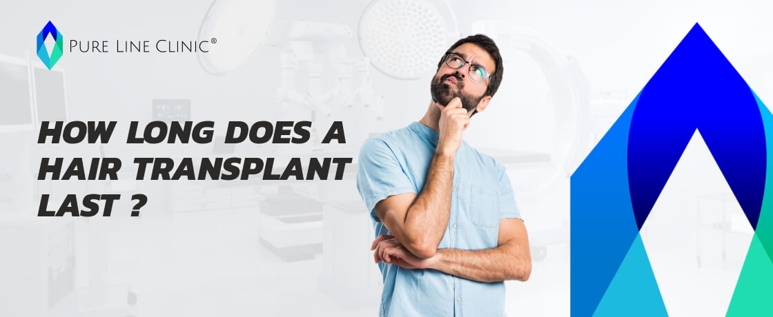 How Long Does a Hair Transplant Last?