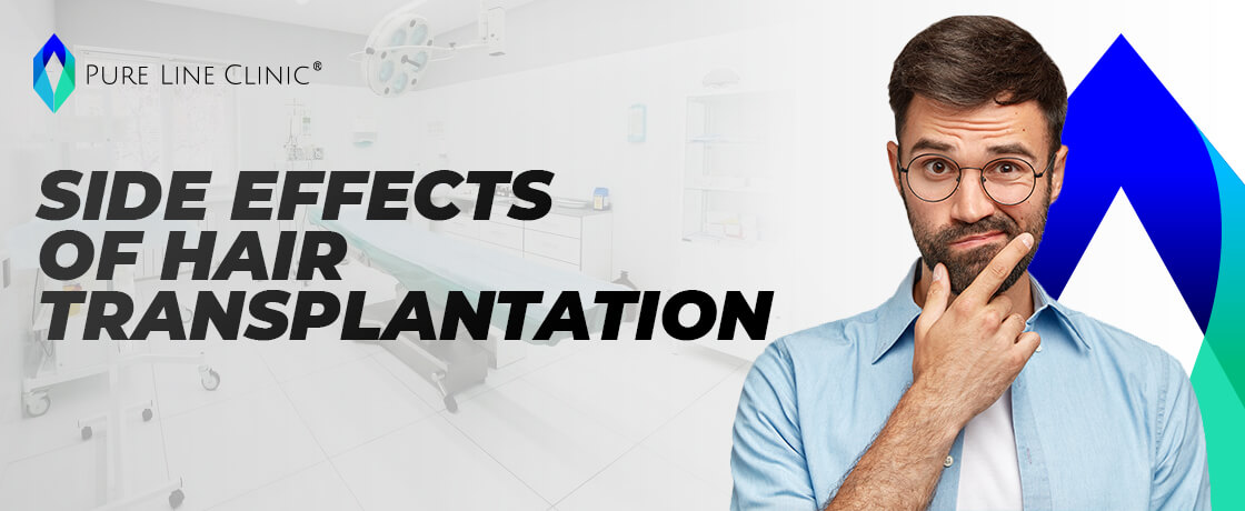 Side Effects of Hair Transplantation: What You Need to Know