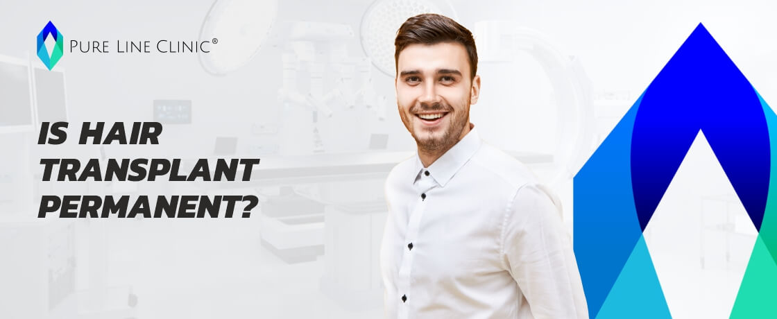 Is Hair Transplant Permanent? 