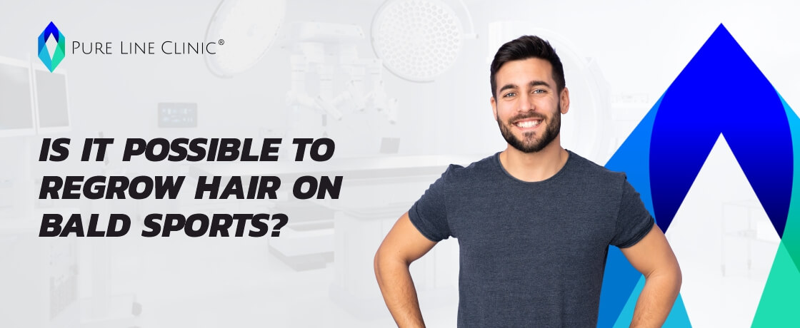 Is It Possible to Regrow Hair on Bald Spots? 