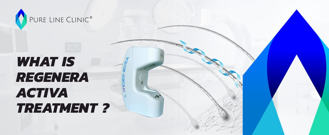 What is Regenera Activa Treatment?