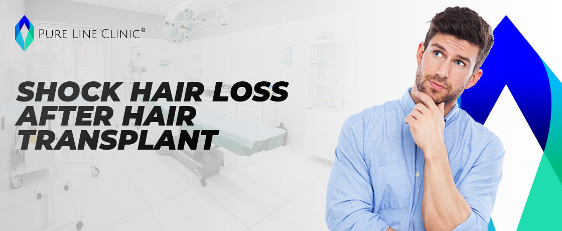 Shock Hair Loss After Hair Transplant