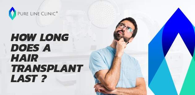 How Long Does a Hair Transplant Last?