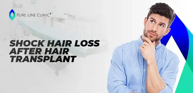 Shock Hair Loss After Hair Transplant