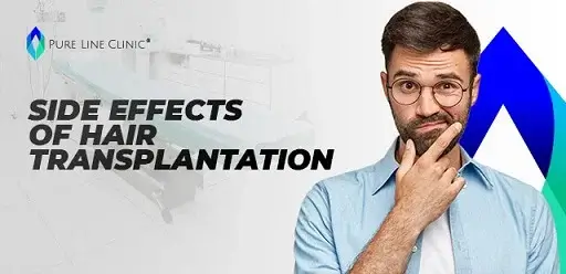 Side Effects of Hair Transplantation: What You Need to Know